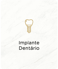 Implantes Dentários